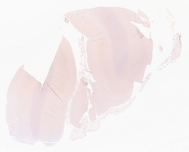 ['deident_83652a56-068a-480a-8994-0c38544d69ab_69d9678d.jpg']