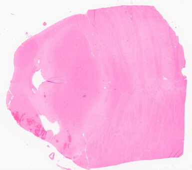 ['deident_0d77fcef-223b-48f5-8287-30ae20e48a9d_69d9675a.jpg']