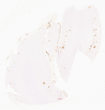 ['deident_4fe2ed7e-aa6c-4840-a5b8-99cd196b37d1_69d96779.jpg']