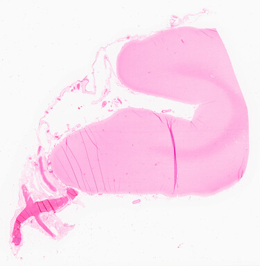 ['deident_deb0b5cf-bbad-403f-82bc-c02ff44d21c3_69d967c8.jpg']