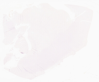 ['deident_e5213e4b-6f80-459f-b9dc-9b80fdfa8bc4_69d967cc.jpg']