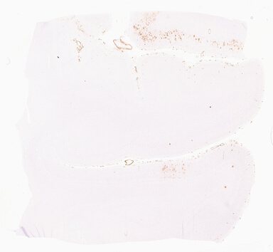 ['deident_1f30871b-0f02-4ca5-ae4e-6e1e3b7d5d02_69d9675e.jpg']