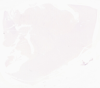 ['deident_8bd0a7a5-a292-4f4e-a630-ee7bf277e949_69d96791.jpg']