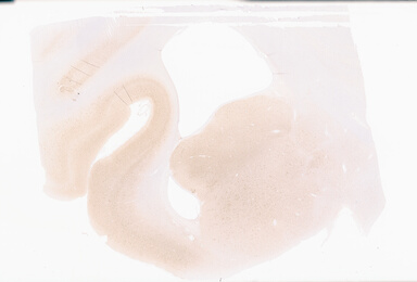['deident_a5d334be-a069-4fbb-840f-fea2a6984b10_69b0597e.jpg']