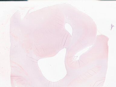 ['deident_933ac8e0-80c9-4e84-85d3-14a8936312dd_69b0596c.jpg']