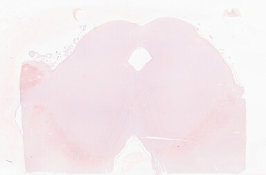 ['deident_962938e0-fa81-425c-b915-c3f2d74f301c_69b05972.jpg']