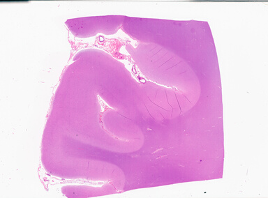 ['deident_7b5a1db8-1819-4d33-999a-5f5e53154f83_69b0595f.jpg']