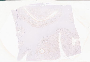['deident_3e01f398-eae3-4bd9-9c1c-409ff5f7ea75_69b05948.jpg']