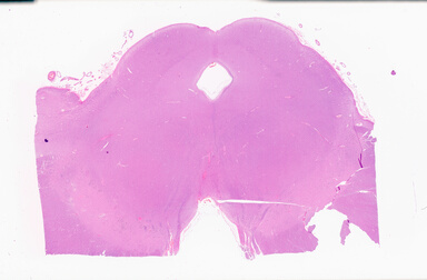 ['deident_345d1dfd-0412-4e6d-bb5f-04610f60651e_69b0593b.jpg']