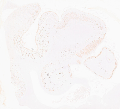 ['deident_2e7608a0-db90-4775-a497-5cb37fe8a6e8_69b05939.jpg']