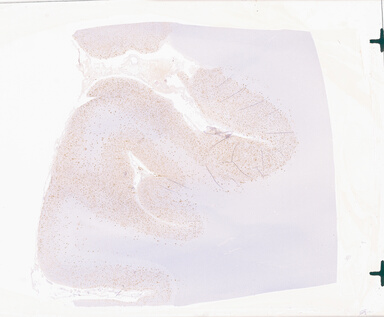 ['deident_d29a7f85-c026-4ce1-a994-e61285db1511_69b05992.jpg']