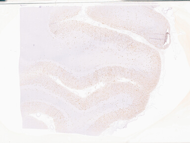 ['deident_7cd8a0d9-b7ab-4344-a4bc-a30dd026af51_69b05961.jpg']