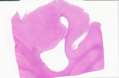 ['deident_f880828a-93ae-4b99-ae96-fbe9fbf35af4_69b0599e.jpg']