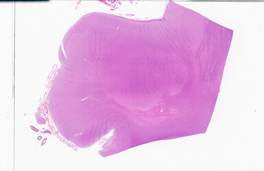 ['deident_8b5d5b58-6d7d-4c1b-8c7d-c05d25e17cd9_69b05965.jpg']
