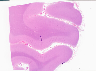 ['deident_75156362-5db5-44f8-a1e4-9ef26b01c089_69b0595b.jpg']