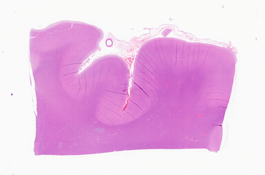['deident_547949f2-bef6-4327-a5df-cab0042285c5_69b0594f.jpg']
