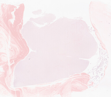['deident_0821469f-70c4-4135-9afd-fda94828d9a1_69b0592c.jpg']