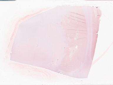 ['deident_fc3a7bd8-d91d-471d-bcd5-55d061c6416b_69b059a3.jpg']