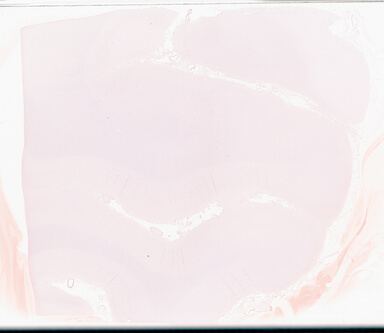 ['deident_f8002c3c-b1fc-409c-94eb-eaa839e20d43_69b0599c.jpg']