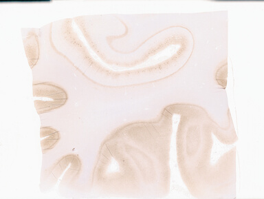 ['deident_76fa0890-dc63-4ac2-9f28-fdb18ea7aa08_69b0595d.jpg']