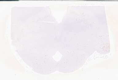 ['deident_d80e4bfc-123e-4e14-9284-18302e97662e_69b05994.jpg']