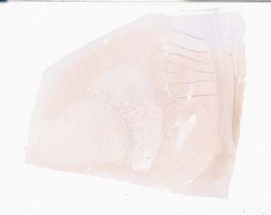 ['deident_e1e61c64-c85e-438b-b4f7-89de1bb2d5fe_69b05998.jpg']
