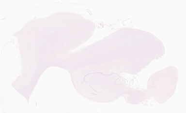 ['deident_43f8333b-6795-410f-8c15-a8dd0bf811ed_69d96b45.jpg']
