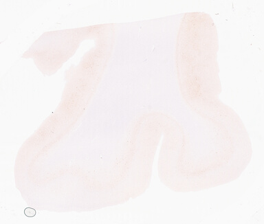 ['deident_baf0266c-c27b-41ad-a9d7-f435382a56d9_69d96b93.jpg']