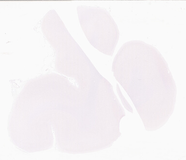 ['deident_d1a181fc-bbb5-419c-ab39-143c707403d2_69d96b9e.jpg']