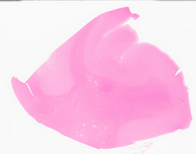 ['deident_e6711a21-9a94-40e8-9087-c3b5005defe3_69d96bac.jpg']