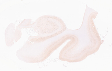 ['deident_2b0ade71-ea25-4a07-9baa-6b0c0b440c38_69d96b37.jpg']