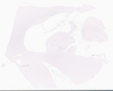 ['deident_a2ddf560-9e0e-492e-843c-24bad8e1559d_69d96b8c.jpg']