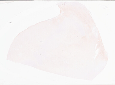 ['deident_2228dce0-b8a6-4c54-95cc-fb5bd0136b58_69d96b2f.jpg']