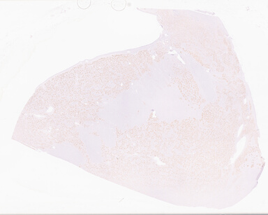 ['deident_1bc46586-50cb-4be1-9dcd-2f86a685a695_69d96b2a.jpg']