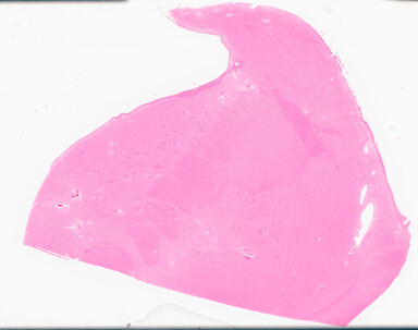 ['deident_956d5ab1-7c3f-4a1c-bb69-6c03464a7dcd_69d96b84.jpg']