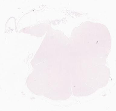 ['deident_e33b7b08-2461-422f-aa64-004eac1ab5c0_69d96ba7.jpg']