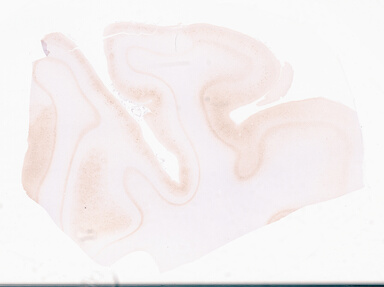 ['deident_7b0a17d7-4cba-4f49-97d0-57bd86d89e92_69d96b71.jpg']