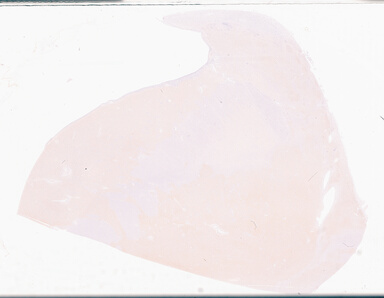 ['deident_85bfb023-6ca8-4c1a-a508-f96f2c171d1d_69d96b79.jpg']