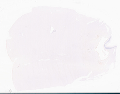 ['deident_b62501f7-713b-4e41-9dae-0c45e7ac78f8_69d96b91.jpg']