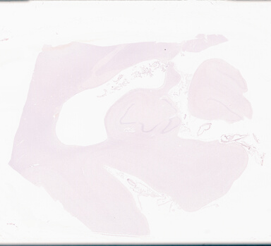 ['deident_2cbd7e19-f4e4-4142-885e-8af465dea159_69d96b3a.jpg']