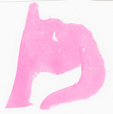 ['deident_489a3dff-cc63-4794-8994-79e51979bc08_69d96b4a.jpg']