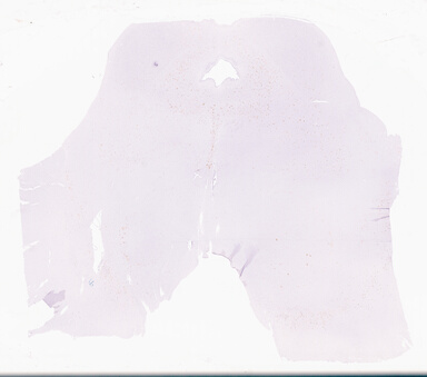 ['deident_277816a9-a2cd-48cb-9c23-f0380622dcfa_69d96b34.jpg']