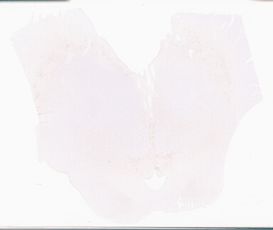 ['deident_0998d3d3-9ff8-47cb-9993-04eb102272fd_69d96b1d.jpg']