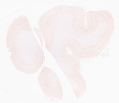 ['deident_decdf3dd-fa1d-44f8-b3fd-bdacf6575b02_69d96ba3.jpg']