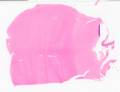 ['deident_5e8f0fe5-0974-4ae9-9dcd-e01c93189cdc_69d96b5c.jpg']