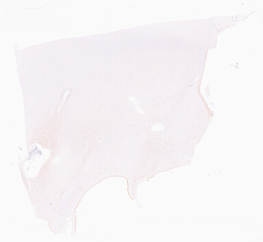 ['deident_30765c0f-779c-45af-bb7f-425c90962d24_69d96b3c.jpg']