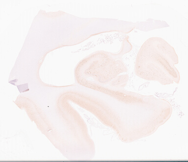 ['deident_d0db233b-f2d9-4336-89c1-1b98c7421329_69d96b9c.jpg']