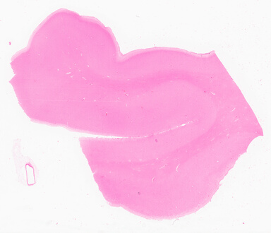 ['deident_dea4d7c0-ec50-47b1-86d2-776685529c07_69d96ba1.jpg']
