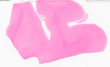 ['deident_afcde23a-782c-45e6-9d23-dfd29e670611_69d96b8e.jpg']