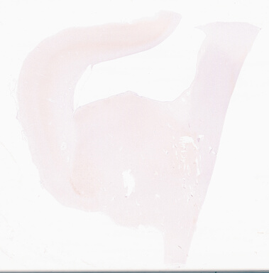 ['deident_6a1ace4e-7f35-47bb-a32e-da6979236638_69d96b68.jpg']
